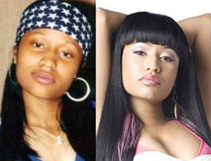 wpid-Nicki-Minaj-face-before-and-after-plastic-surgery
